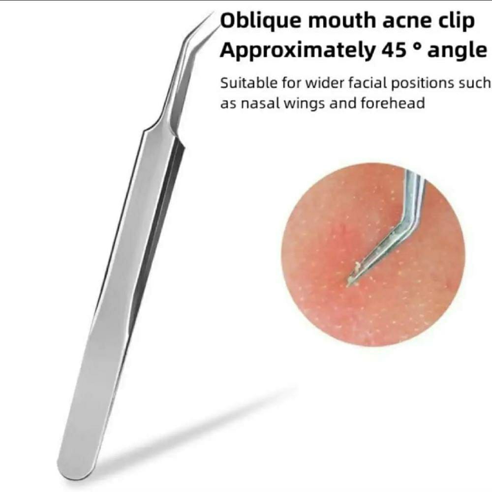 8 Pcs White and Blackhead Remover Tools