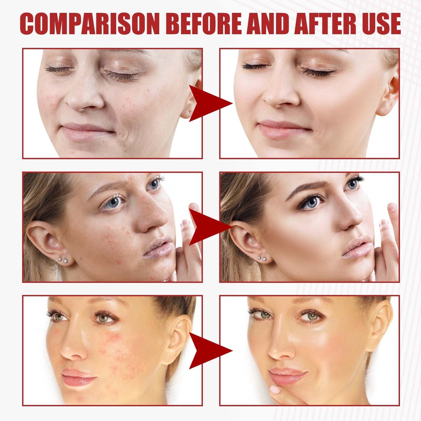 Anti-Wrinkle Facial Skin Care Repair Fade Facial Fine Lines Exosome Kinetic Energy